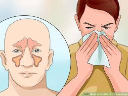 How to Get Rid of Runny Nose