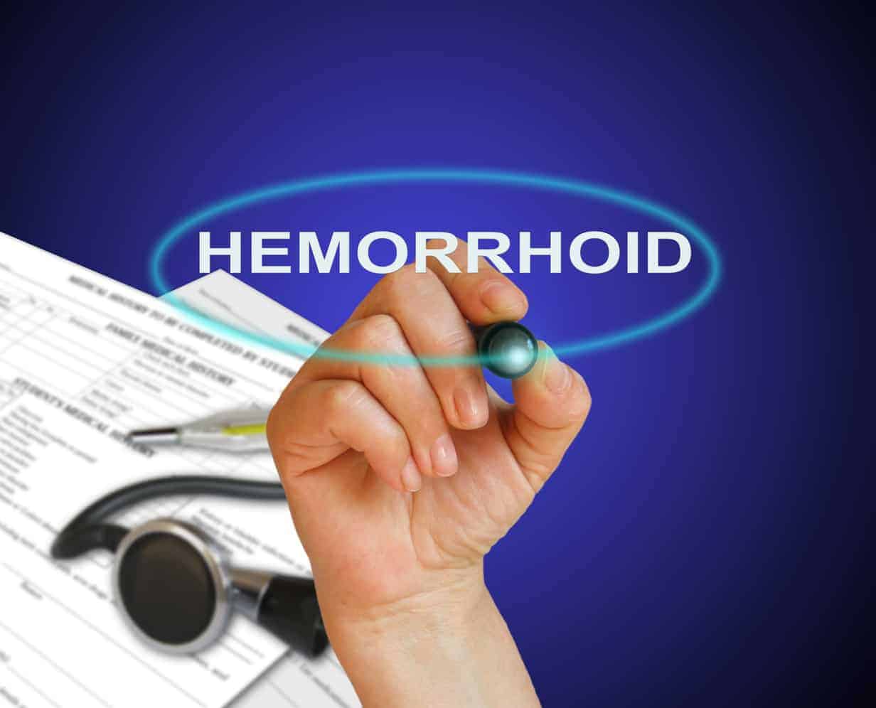 How to get rid of hemroids fast naturally – 11 home remedies